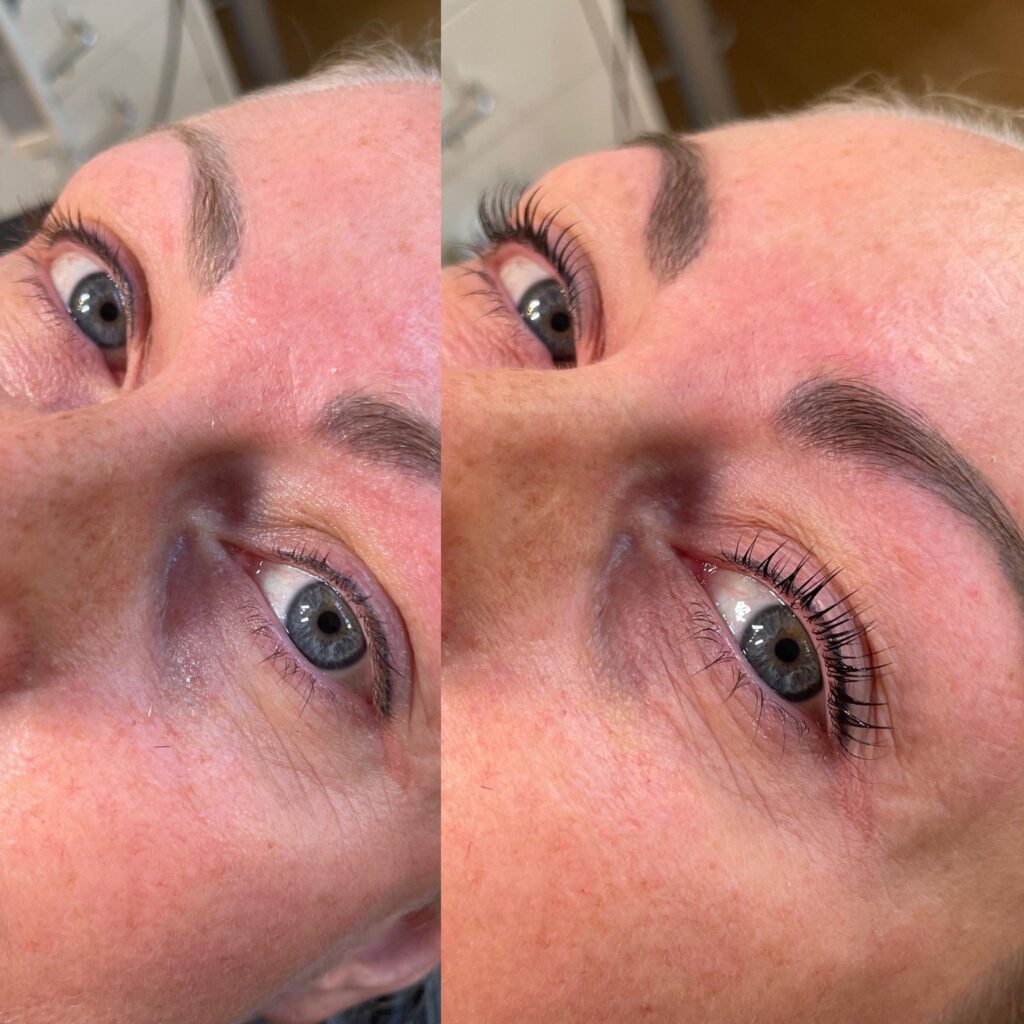 Lash/Browlift